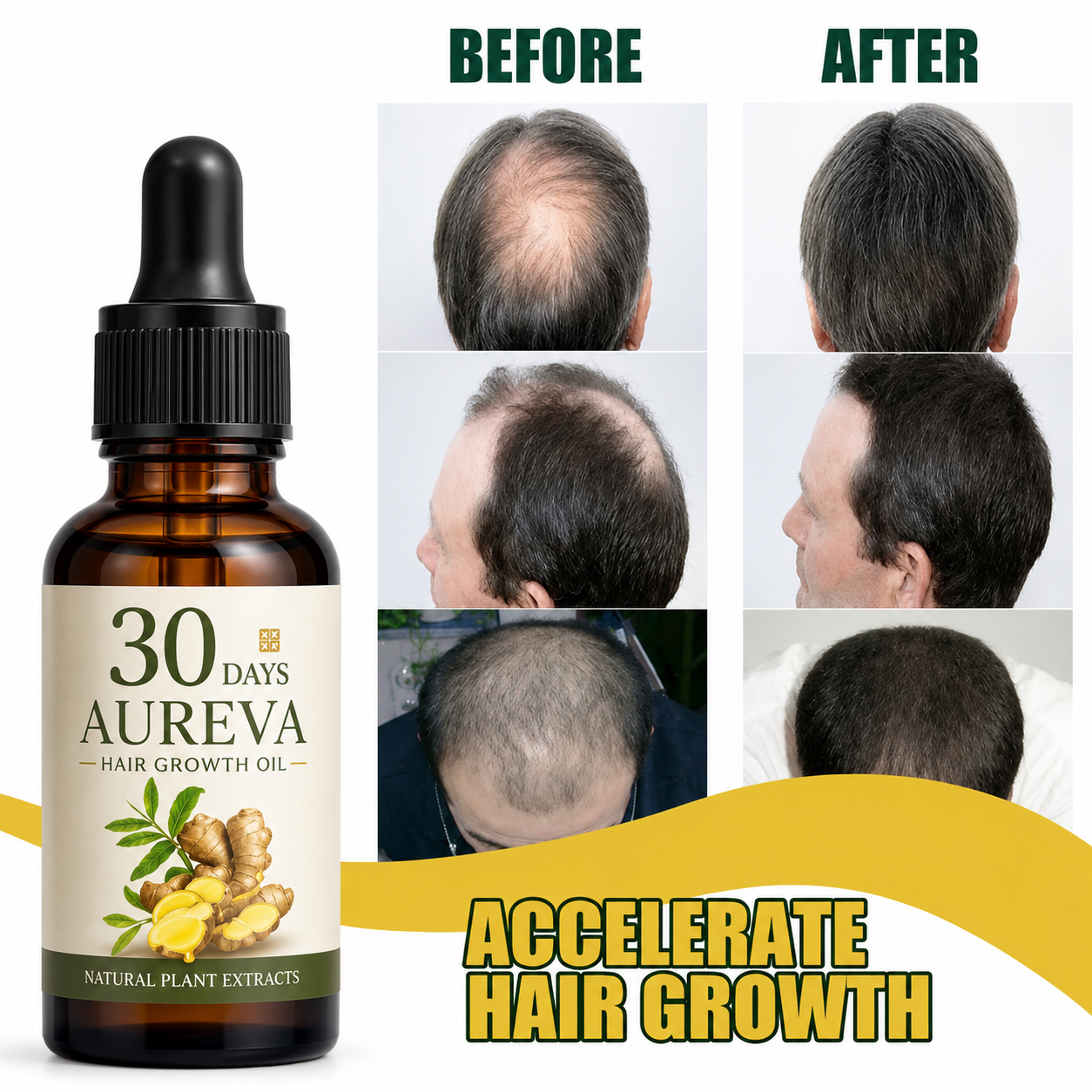 Aureva Hair Growth Oil Men And Women