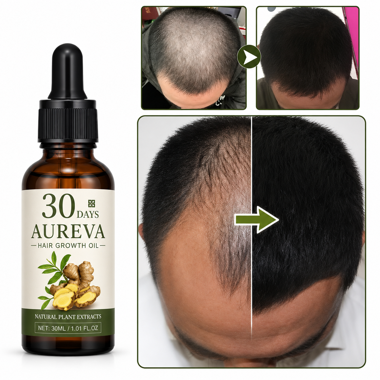 Aureva Hair Growth Oil Men And Women